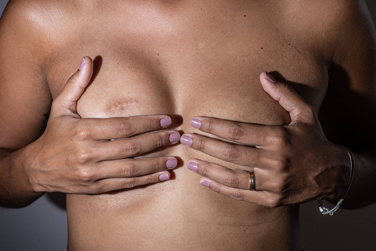 Calor extremo aumenta casos de câncer feminino, diz estudo - 29/05/2025 - Equilíbrio e Saúde