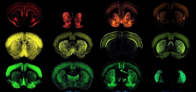 Os pesquisadores desenvolvem um novo conjunto de ferramentas genéticas projetadas para tratar doenças cerebrais