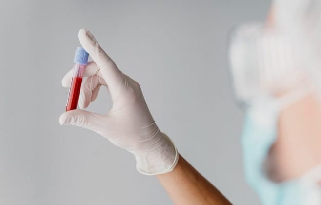 Hantavírus: infectologista da HU Brasil explica transmissão, sintomas e prevenção